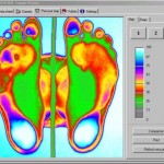 Biomecánica y Estudio informatico del pie en Villaviciosa Asturias